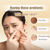 Load image into Gallery viewer, Bird's Nest EGF Facial Mask with Collagen (Box of 5)